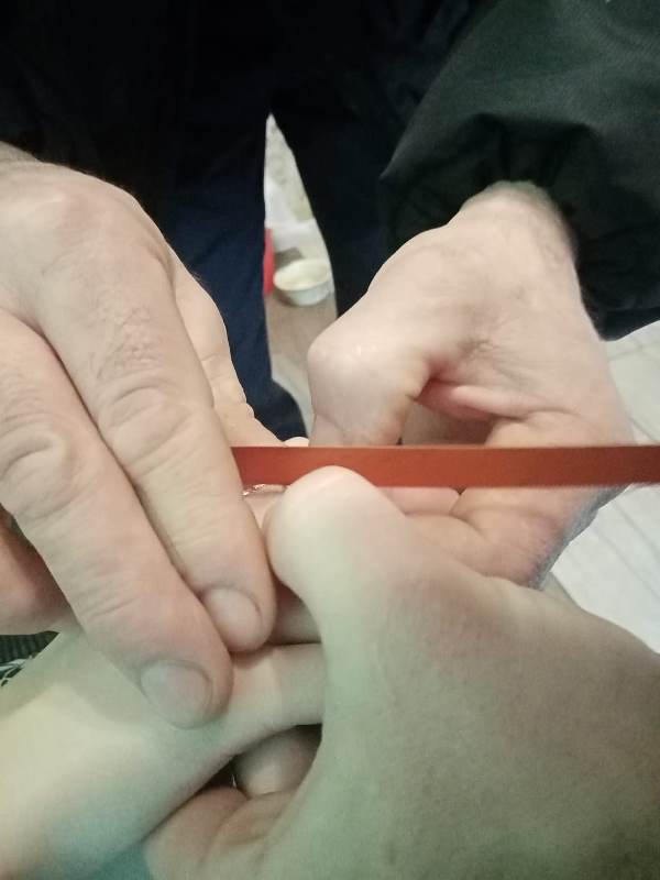 Спасатели ГКУ МО «Мособлпожспас» освободили палец девочки от застрявшего кольца